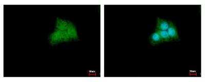 Immunocytochemistry/Immunofluorescence: CDK20 Antibody [NBP1-32415] - Sample: HepG2 cells were fixed in 4% paraformaldehyde at RT for 15 min. Green: CCRK protein stained by CCRK antibody diluted at 1:500. Blue: Hoechst 33343 staining.