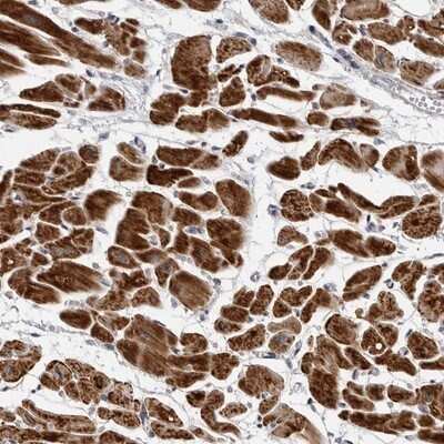 Immunohistochemistry-Paraffin: CDK20 Antibody [NBP1-91213] - Staining of human heart muscle shows strong cytoplasmic positivity in myocytes.