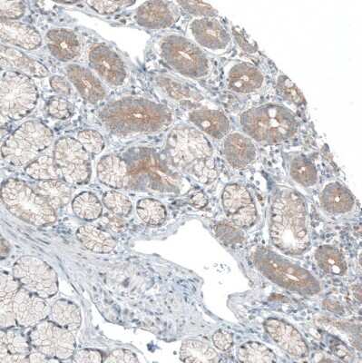 Immunohistochemistry-Paraffin: CDK20 Antibody [NBP1-91214] - Staining of human duodenum shows weak cytoplasmic positivity in glandular cells.