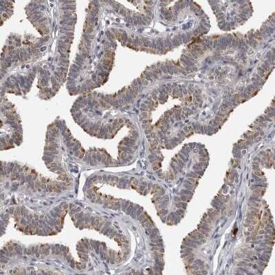 Immunohistochemistry-Paraffin: CDK20 Antibody [NBP1-91215] - Staining of human fallopian tube shows high expression.