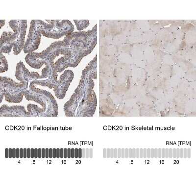 Immunohistochemistry-Paraffin: CDK20 Antibody [NBP1-91215] - Staining in human fallopian tube and skeletal muscle tissues using anti-CDK20 antibody. Corresponding CDK20 RNA-seq data are presented for the same tissues.