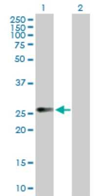 Western Blot: CDK20 Antibody [H00023552-B01P] - Analysis of CCRK expression in transfected 293T cell line by CCRK polyclonal antibody.  Lane 1: CCRK transfected lysate(30.25 KDa). Lane 2: Non-transfected lysate.