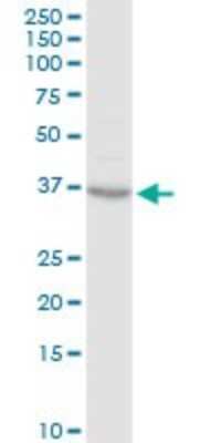 Western Blot: CDK20 Antibody [H00023552-D01P] - Analysis of CCRK expression in Jurkat.