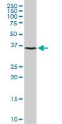 Western Blot: CDK20 Antibody [H00023552-D01P] - Analysis of CCRK expression in human kidney.