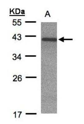 Western Blot: CDK20 Antibody [NBP1-32415] - Sample(30 ug whole cell lysate)A:Hep G2  12% SDS PAGE, antibody diluted at 1:500.