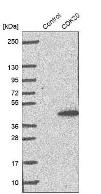 Western Blot: CDK20 Antibody [NBP1-91213] - Analysis in control (vector only transfected HEK293T lysate) and CDK20 over-expression lysate (Co-expressed with a C-terminal myc-DDK tag (3.1 kDa) in mammalian HEK293T cells).