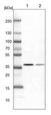 Western Blot: CDK20 Antibody [NBP1-91214] - Lane 1: NIH-3T3 cell lysate (Mouse embryonic fibroblast cells). Lane 2: NBT-II cell lysate (Rat Wistar bladder tumor cells).