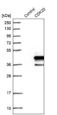 <b>Orthogonal Strategies Validation. </b>Western Blot: CDK20 Antibody [NBP1-91215] - Analysis in control (vector only transfected HEK293T lysate) and CDK20 over-expression lysate (Co-expressed with a C-terminal myc-DDK tag (3.1 kDa) in mammalian HEK293T cells).