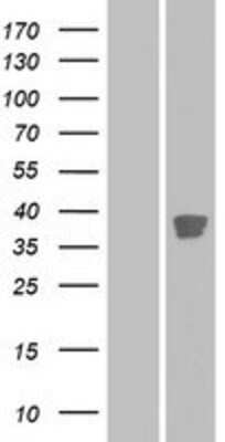 Western Blot CDK20 Overexpression Lysate