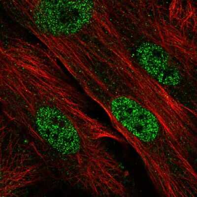 Immunocytochemistry/Immunofluorescence: CDK2AP1 Antibody [NBP2-56924] - Staining of human cell line BJ shows localization to nucleoplasm.