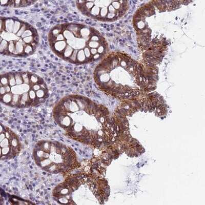 Immunohistochemistry-Paraffin: CDK2AP2 Antibody [NBP1-91776] - Staining of human colon shows moderate cytoplasmic and membranous positivity in glandular cells.