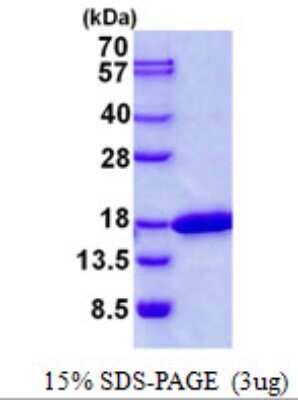 SDS-PAGE Recombinant Human CDK2AP2 His Protein