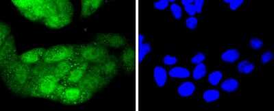 Immunocytochemistry/Immunofluorescence: CDK4 Antibody (SD20-42) [NBP2-67736] - Staining Cdk4 in Hela cells (green). The nuclear counter stain is DAPI (blue). Cells were fixed in paraformaldehyde, permeabilised with 0.25% Triton X100/PBS.