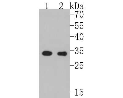 Western Blot: CDK4 Antibody (SD20-42) [NBP2-67736] - Western blot analysis of CDK4 on different lysates. Proteins were transferred to a PVDF membrane and blocked with 5% BSA in PBS for 1 hour at room temperature. The primary antibody (1/500) was used in 5% BSA at room temperature for 2 hours. Goat Anti-Rabb