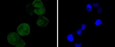 Immunocytochemistry/Immunofluorescence: CDK4 Antibody (SD205-1) [NBP2-67751] - Staining Cdk4 in Hela cells (green). The nuclear counter stain is DAPI (blue). Cells were fixed in paraformaldehyde, permeabilised with 0.25% Triton X100/PBS.