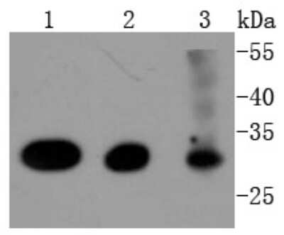 Western Blot: CDK4 Antibody (SD205-1) [NBP2-67751] - Analysis of Cdk4 on different lysates using anti-Cdk4 antibody at 1/1,000 dilution. Positive control: Lane 1: Hela Lane 2: MCF-7 Lane 3: K562