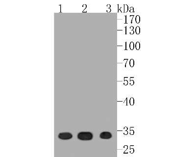Western Blot: CDK4 Antibody (SD205-1) [NBP2-67751] - Western blot analysis of CDK4 on different lysates. Proteins were transferred to a PVDF membrane and blocked with 5% BSA in PBS for 1 hour at room temperature. The primary antibody (1/500) was used in 5% BSA at room temperature for 2 hours. Goat Anti-Rabb