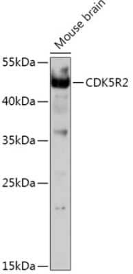 Western Blot: CDK5R2 Antibody [NBP2-92362] - Analysis of extracts of Mouse brain, using CDK5R2 at 1:1000 dilution.Secondary antibody: HRP Goat Anti-Rabbit IgG (H+L) at 1:10000 dilution.Lysates/proteins: 25ug per lane.Blocking buffer: 3% nonfat dry milk in TBST.Detection: ECL Basic Kit .Exposure time