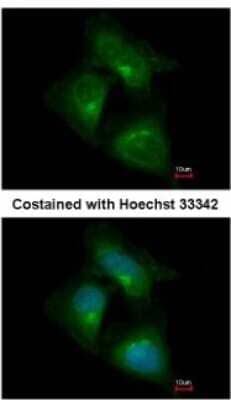 Immunocytochemistry/Immunofluorescence: CDK5RAP1 Antibody [NBP2-15844] - Analysis of paraformaldehyde-fixed HeLa, using antibody at 1:500 dilution.