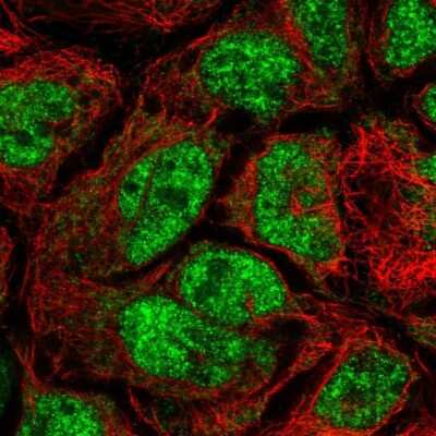 Immunocytochemistry/Immunofluorescence: CDK5RAP1 Antibody [NBP2-55839] - Staining of human cell line CACO-2 shows localization to nuclear speckles & mitochondria.