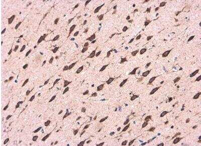 Immunohistochemistry-Paraffin: CDK5RAP1 Antibody [NBP2-15844] - Paraffin-embedded Rat brain. CDK5RAP1 antibody diluted at 1:500.