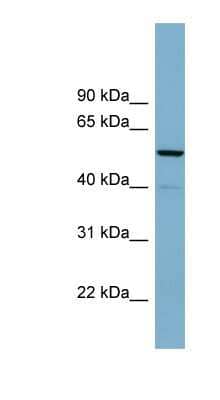 Western Blot: CDK5RAP1 Antibody [NBP1-58246] - Human Brain lysate, concentration 0.2-1 ug/ml.