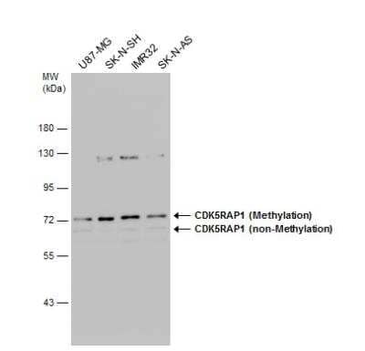 Western Blot: CDK5RAP1 Antibody [NBP2-15844] - Various whole cell extracts (30 ug) were separated by 7.5% SDS-PAGE, and the membrane was blotted with CDK5RAP1 antibody diluted at 1:500.