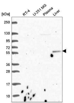 Western Blot: CDK5RAP1 Antibody [NBP2-55839] - Western blot analysis in human cell line RT-4, human cell line U-251 MG, human plasma and human liver tissue.