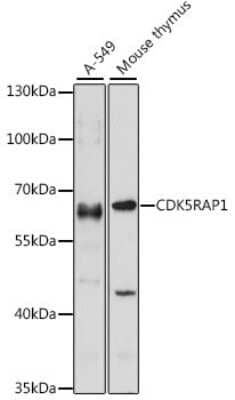 Western Blot: CDK5RAP1 Antibody [NBP2-92870] - Analysis of extracts of various cell lines, using CDK5RAP1 .Exposure time: 30s.