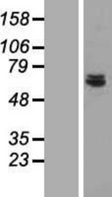 Western Blot: CDK5RAP1 Overexpression Lysate (Adult Normal) [NBL1-09042] Left-Empty vector transfected control cell lysate (HEK293 cell lysate); Right -Over-expression Lysate for CDK5RAP1.