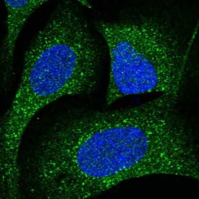 Immunocytochemistry/ Immunofluorescence CDK5RAP3 Antibody