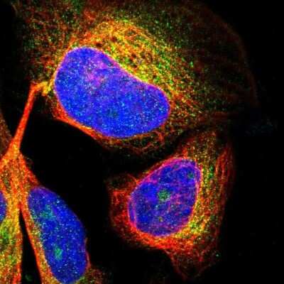 <b>Genetic Strategies Validation. </b>Immunocytochemistry/Immunofluorescence: CDK5RAP3 Antibody [NBP1-86780] - Staining of human cell line U-2 OS shows localization to nucleoli & cytosol.