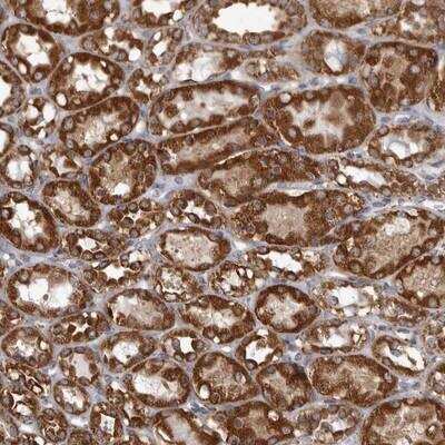 Immunohistochemistry: CDK5RAP3 Antibody [NBP1-86778] - Staining of human kidney shows strong cytoplasmic positivity in tubule cells.