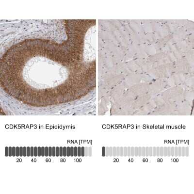 Immunohistochemistry-Paraffin: CDK5RAP3 Antibody [NBP1-86778] - Analysis in human epididymis and skeletal muscle tissues using NBP1-86778 antibody. Corresponding CDK5RAP3 RNA-seq data are presented for the same tissues.