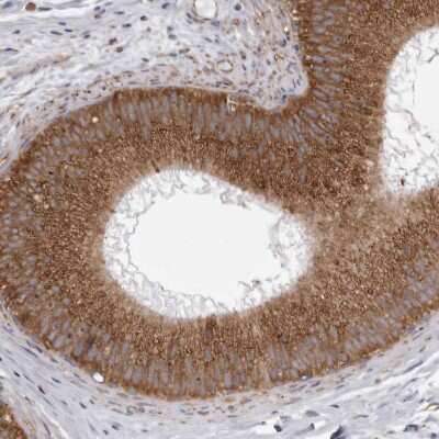 Immunohistochemistry-Paraffin: CDK5RAP3 Antibody [NBP1-86778] - Staining of human epididymis shows strong cytoplasmic positivity in glandular cells.