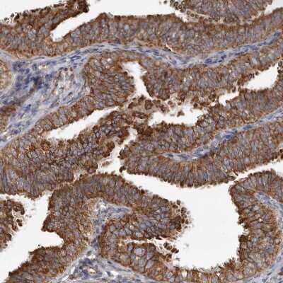 Immunohistochemistry-Paraffin: CDK5RAP3 Antibody [NBP1-86778] - Staining of human fallopian tube shows strong cytoplasmic positivity in glandular cells.