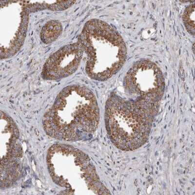 Immunohistochemistry-Paraffin: CDK5RAP3 Antibody [NBP1-86778] - Staining of human prostate shows strong cytoplasmic positivity in glandular cells.