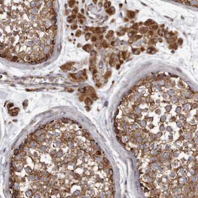 Immunohistochemistry-Paraffin: CDK5RAP3 Antibody [NBP1-86778] - Staining of human testis shows strong cytoplasmic positivity in cells in seminiferous ducts and leydig cells.