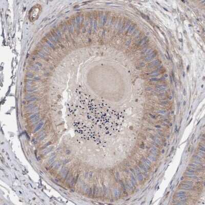 Immunohistochemistry-Paraffin: CDK5RAP3 Antibody [NBP1-86779] - Staining of human epididymis shows  moderate cytoplasmic positivity in glandular cells.