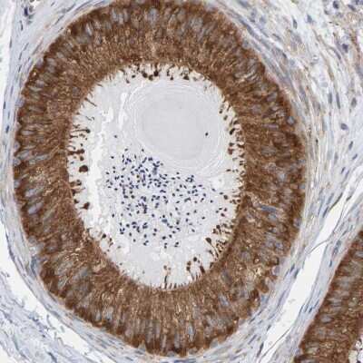 Immunohistochemistry-Paraffin: CDK5RAP3 Antibody [NBP1-86780] - Staining of human epididymis shows strong cytoplasmic positivity in glandular cells.