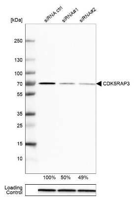 Western Blot CDK5RAP3 Antibody