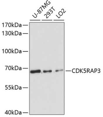 Western Blot: CDK5RAP3 Antibody [NBP2-92612] - Analysis of extracts of various cell lines, using CDK5RAP3 at 1:3000 dilution.Secondary antibody: HRP Goat Anti-Rabbit IgG (H+L) at 1:10000 dilution.Lysates/proteins: 25ug per lane.Blocking buffer: 3% nonfat dry milk in TBST.Detection: ECL Basic Kit .Exposure time: 90s.