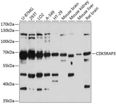 Western Blot: CDK5RAP3 Antibody [NBP2-92890] - Analysis of extracts of various cell lines, using CDK5RAP3 .Exposure time: 90s.