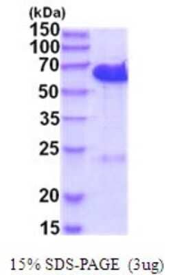 SDS-PAGE Recombinant Human CDK5RAP3 His Protein