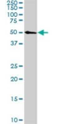 Western Blot: CDK8 Antibody (2E6) [H00001024-M04] - Analysis of CDK8 expression in Raw 264.7 (Cat # L024V1).