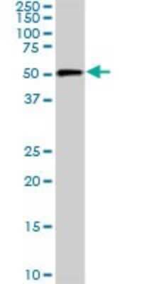 Western Blot: CDK8 Antibody (2E6) [H00001024-M04] - Analysis of CDK8 expression in NIH/3T3 (Cat # L018V1).