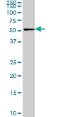 Western Blot: CDK8 Antibody (6E5) [H00001024-M02] - CDK8 monoclonal antibody (M02), clone 6E5. Analysis of CDK8 expression in PC-12.