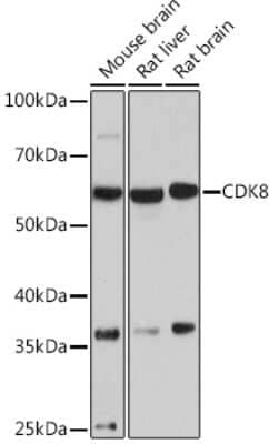 Western Blot: CDK8 Antibody (7L5X2) [NBP3-16850] - Western blot analysis of extracts of various cell lines, using CDK8 Rabbit mAb (NBP3-16850) at 1:1000 dilution. Secondary antibody: HRP Goat Anti-Rabbit IgG (H+L) at 1:10000 dilution. Lysates/proteins: 25ug per lane. Blocking buffer: 3% nonfat dry milk in TBST. Detection: ECL Basic Kit. Exposure time: 90s.