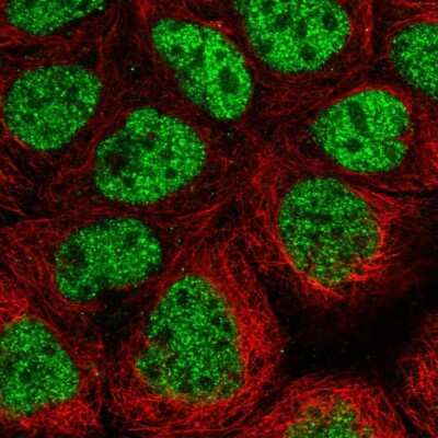 Immunocytochemistry/Immunofluorescence: CDK8 Antibody [NBP2-55134] - Staining of human cell line CACO-2 shows localization to nucleoplasm. Antibody staining is shown in green.