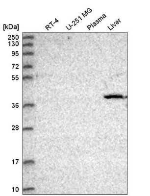 Western Blot: CDK8 Antibody [NBP2-55134] - Analysis in human cell line RT-4, human cell line U-251 MG, human plasma and human liver tissue.